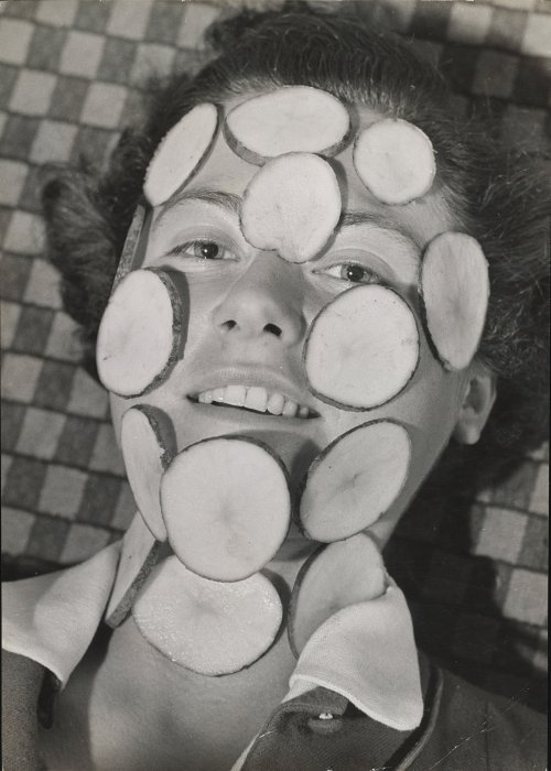 Woman smiling with slices of potato on her face and neck